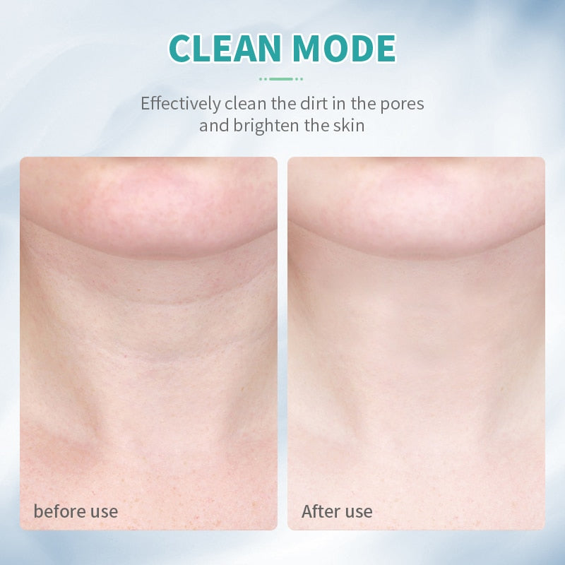 ANLAN Neck Face Beauty Anti Wrinkle Remove