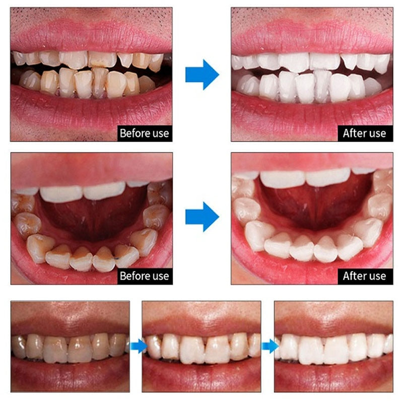 Poudre de blanchiment des dents