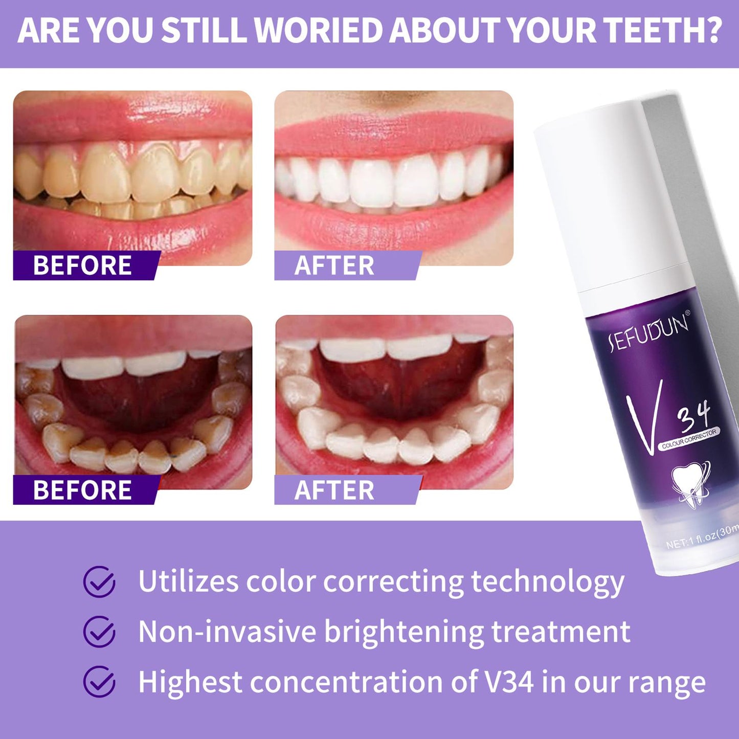 Teeth Whitening Toothpaste V34 Color Tooth Correction