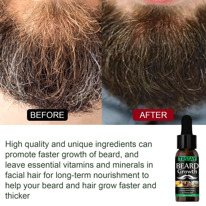 NEW Beard Hair Growth Essential Oil